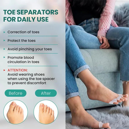 Silicone Toe Separator Bunion Corrector - Foot Care Tool - Fleur de Luxe
